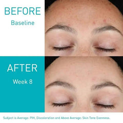 Resurfacing Retinol Serum